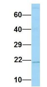 Polyclonal Rabbit anti-Human MARCKSL1 Antibody (C-Terminus, WB)