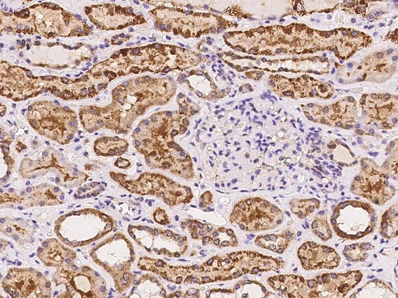 FAM149A Antibody