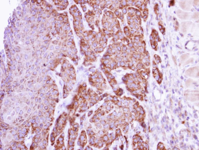 ARG1 / Arginase 1 Antibody (aa1-322)
