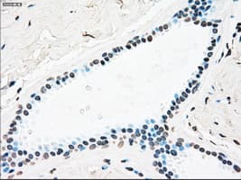 PLK1 / PLK-1 Antibody (clone OTI1A2)