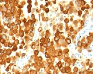 PMEL / SILV / gp100 Antibody (clone PMEL/783)