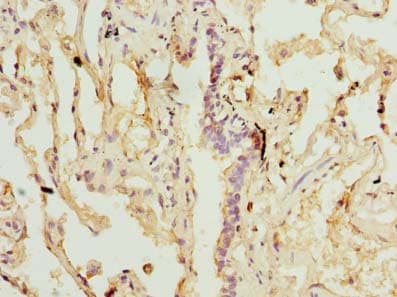 SLA Antibody