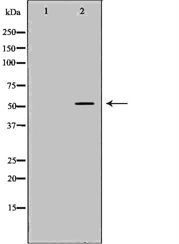 TPH1 / Tryptophan Hydroxylase Antibody