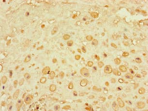 CEP290 Antibody