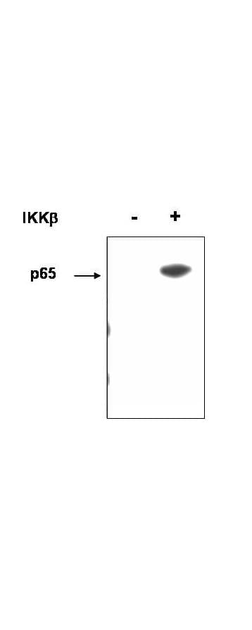 IHC-plus™ Polyclonal Rabbit anti-Human RELA / NFKB p65 Antibody (phospho-Ser536, IHC, WB)