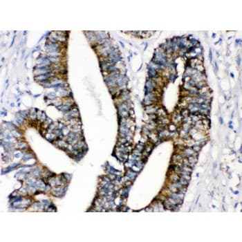 Polyclonal Rabbit anti-Human MAOA / Monoamine Oxidase Antibody (aa457-493, IHC, WB)