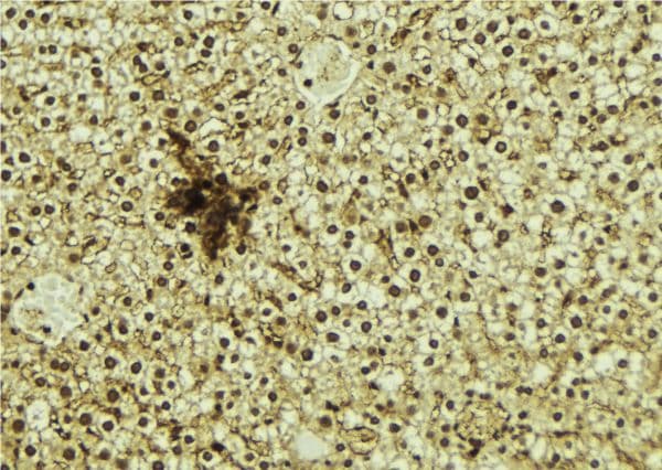 NR1D1 Antibody