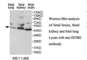 Polyclonal Rabbit anti-Human EFNB2 / Ephrin B2 Antibody (aa31-225, IHC, WB)