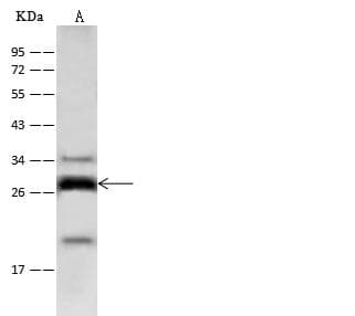 CRP / C-Reactive Protein Antibody (Preservative Free)