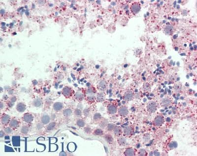 ABCB6 Antibody