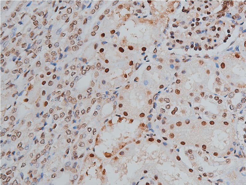 PPP1R12A / MYPT1 Antibody (phospho-Thr853)