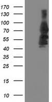 KATNB1 Antibody (clone OTI5E1, Carrier-free)