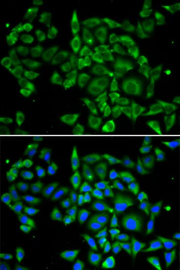 PRKCA / PKC-Alpha Antibody