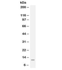 Polyclonal Rabbit anti-Human MGP / Matrix Gla-Protein Antibody (IHC, WB)