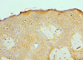 Polyclonal Rabbit anti-Human ACVR2 / ACVR2A Antibody (aa20-140, IHC)