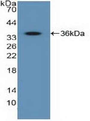 IGF2R / CD222 Antibody (aa2167-2442, PE)