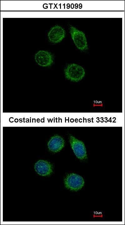 CHST2 Antibody