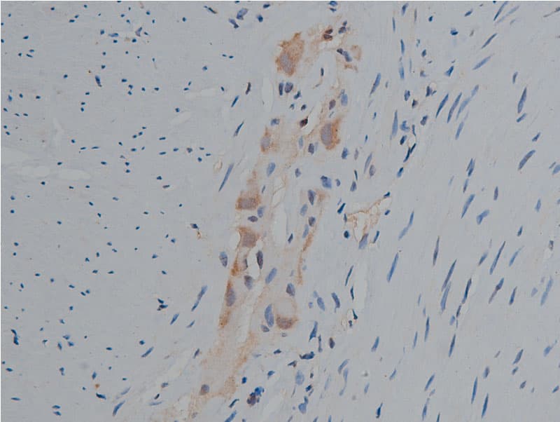 Polyclonal Rabbit anti-Human PLCG1 Antibody (phospho-Tyr771, IHC, IF, WB)