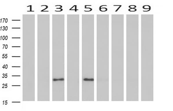 Adiponectin Antibody (aa19-244, clone OTI1B2, Carrier-free)
