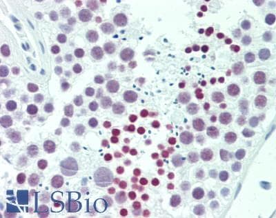 IHC-plus™ NOL4 Antibody (clone 2A10)