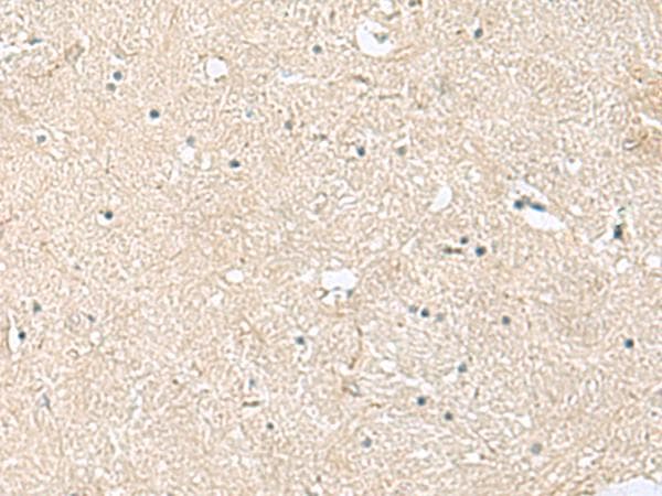 VEGFA / VEGF Antibody