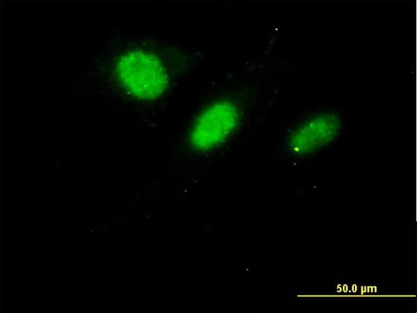 DNAJC7 Antibody (clone 4G6-G3)