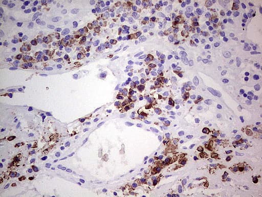 Monoclonal Mouse anti-Human GLI / GLI1 Antibody (clone UMAB170, Carrier-free, aa1-410, IHC, IF, WB)
