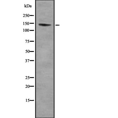 PCDH11X+Y Antibody
