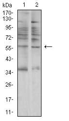 AMY1A / Salivary Amylase Antibody (clone 5G6F7)