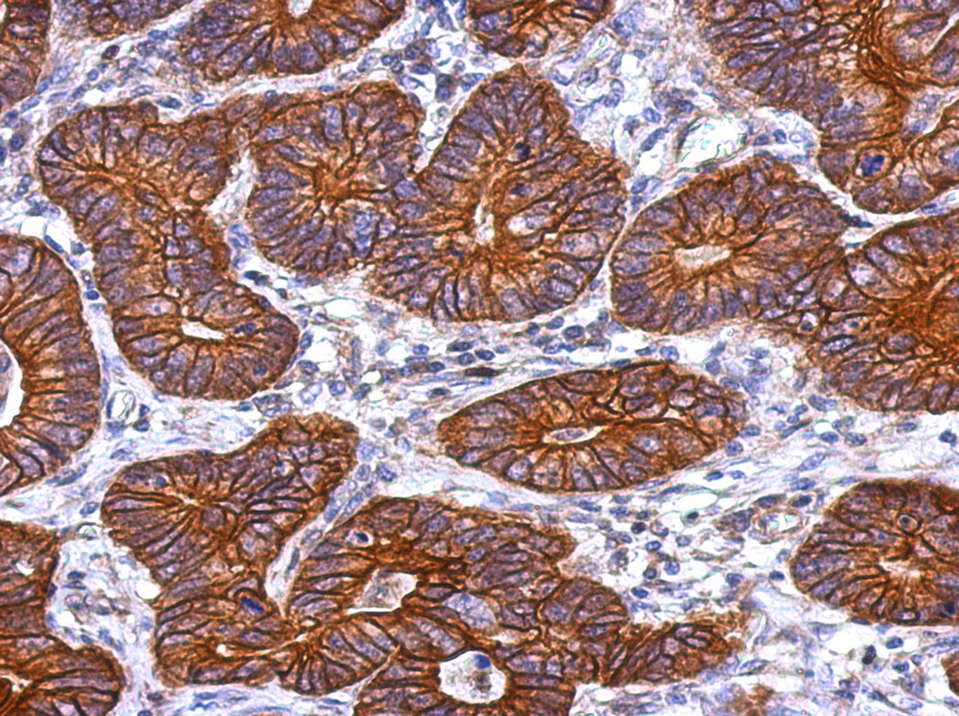 KRT72 / Keratin 72 / K6irs Antibody