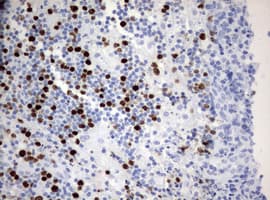 Monoclonal Mouse anti-Human MKI67 / Ki67 Antibody (clone OTI14G1, aa1160-1493, IHC)