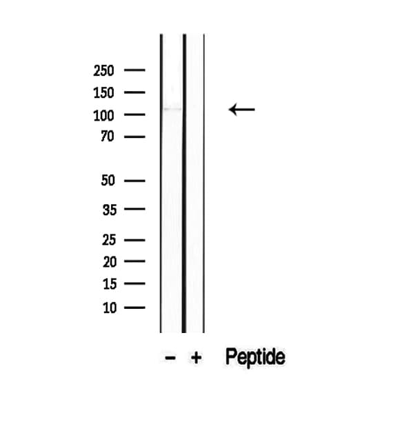 PACS2 Antibody