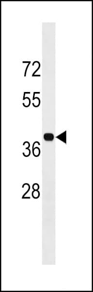 BLVRA Antibody (aa61-89)