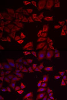 SEPHS1 / SPS Antibody