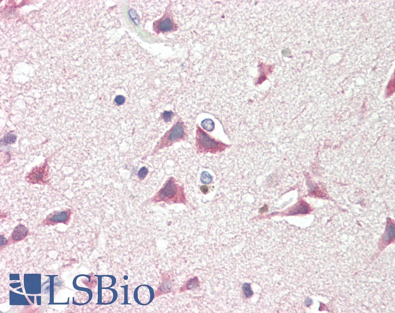 IHC-plus™ Polyclonal Goat anti-Human DCDC2 Antibody (aa352-365, IHC, WB)