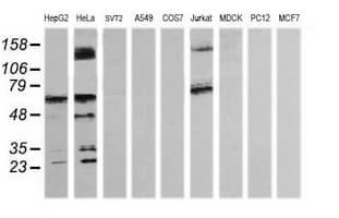 TRMT2A Antibody (clone OTI3D8, Carrier-free)
