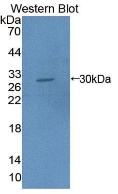 TNNI3 / Cardiac Troponin I Antibody (aa1-211, Cy3)