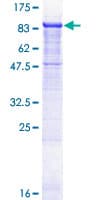 Human TCAB1 / WDR79 Protein (Recombinant GST)