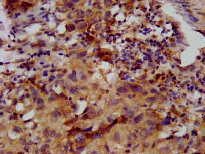 FKRP Antibody (aa28-140)