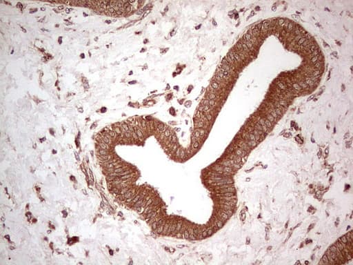 UBE2D2 / UBCH5B Antibody (clone OTI2C2, Carrier-free)