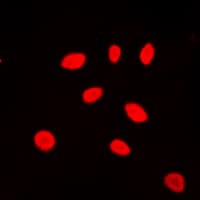 ZNF174 Antibody (Internal)