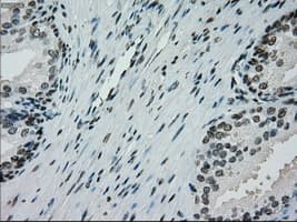 Monoclonal Mouse anti-Human PMEL / SILV / gp100 Antibody (clone OTI10E5, IHC, IF, WB)