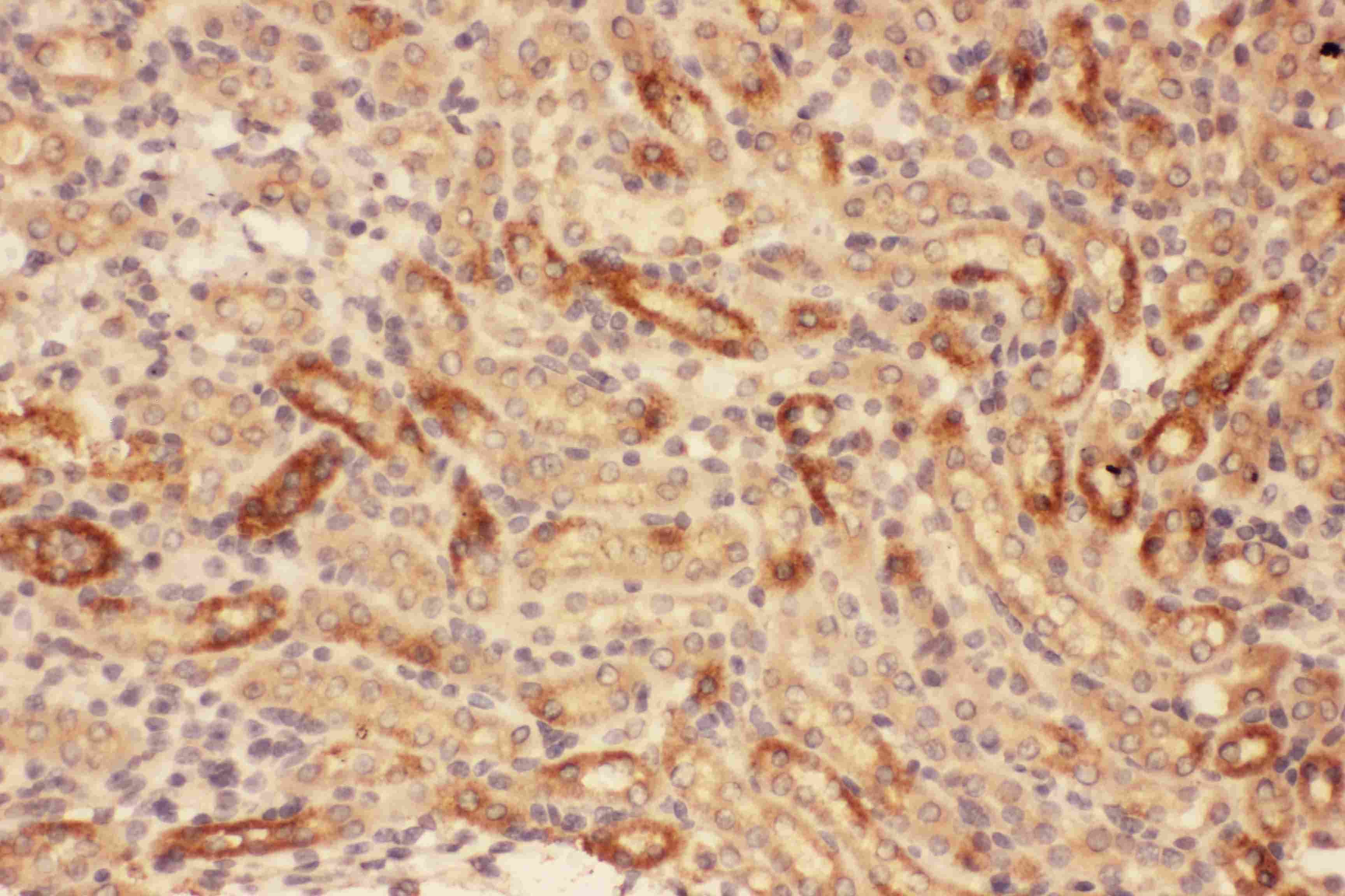 MMP7 / Matrilysin Antibody (aa95-264)