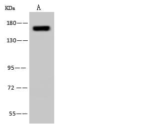 Polyclonal Rabbit anti-Human PFAS Antibody (WB)