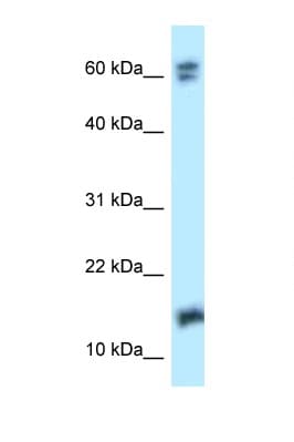 Polyclonal Rabbit anti-Human NUDT2 Antibody (aa53-102, WB)