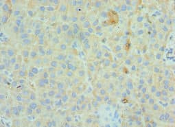 GC / Vitamin D-Binding Protein Antibody (aa305-474)