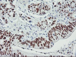 TP53 / p53 Antibody (clone OTI2F7)