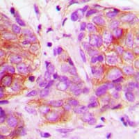 Polyclonal Rabbit anti-Human LYN Antibody (C-Terminus, IHC, IF, WB)