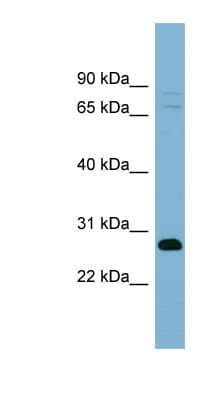 Polyclonal Rabbit anti-Human TMEM176A / HCA112 Antibody (aa143-192, WB)