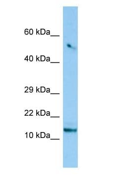 Polyclonal Rabbit anti-Human C8orf4 Antibody (aa29-78, WB)